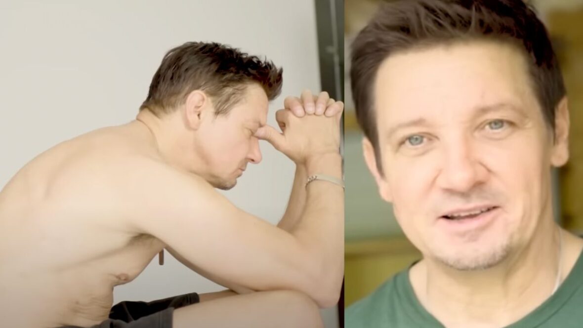 Jeremy Renner, 53, Shows Off His Scars As He Recovers From Snowplow Accident That Nearly Killed Him